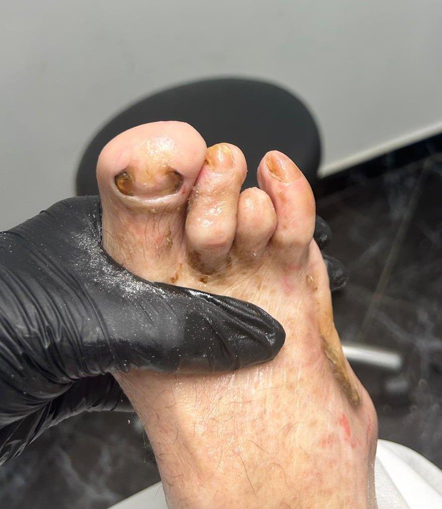 Tratamento podológico 4